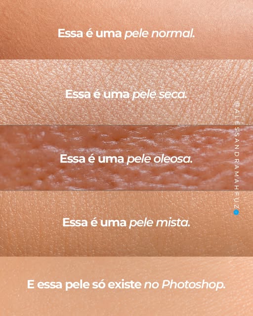 Poros visíveis, pequenas linhas, diferenças de textura e irregularidades fazem parte de uma pele rea