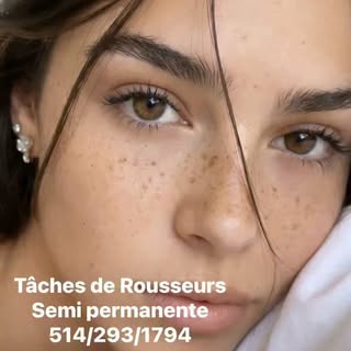 TÂCHES DE ROUSSEURS