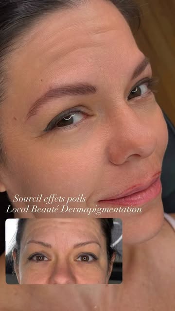 Www.localbeautedermapigmentation.com