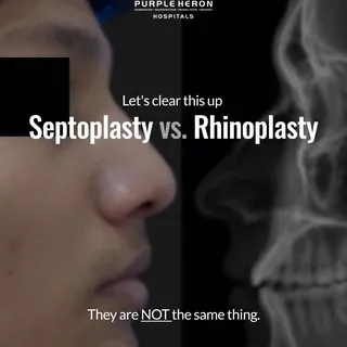 👃🏻 Septoplasty and Rhinoplasty are not the same—but in some cases, they can work together. 🩺✨

Se