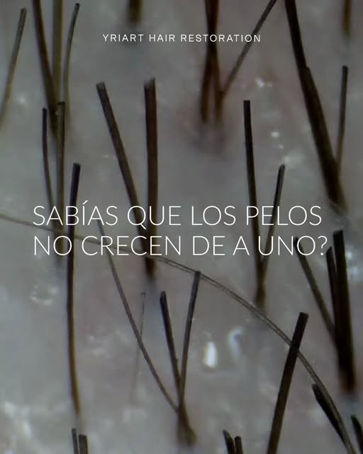 ¿Sabías que los pelos no crecen de a uno? 
En el cuero cabelludo se encuentran organizados en ✨unida
