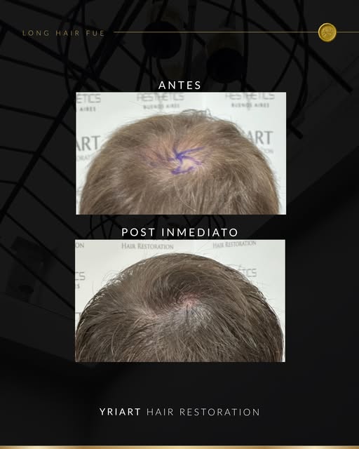 Buscamos recrear el flujo natural, la inclinación adecuada y el marco perfecto para potenciar la mej