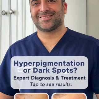 Want to improve your hyperpigmentation or dark spots?

They can be due to many causes and that's why