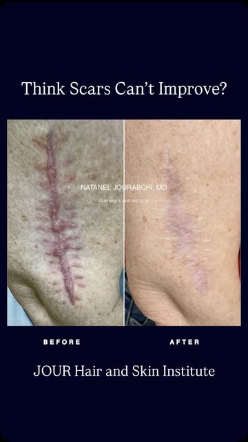 Do you have a scar you wish were less noticeable?

Effective scar treatment is not one size fits all