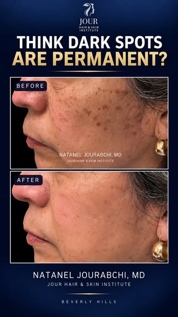 Not all dark spots and pigmentation are the same… and they shouldn’t all be treated the same.

Dark 