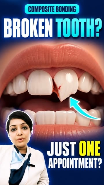 🦷 Chipped Tooth? Don’t Ignore It!

A chipped tooth may look like a small problem, but depending on 