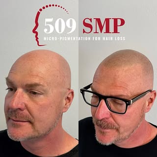Upgrade your look if you are tired of looking at the bald guy in the mirror 😤. There are options, c