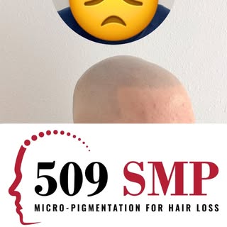 Hello Tri Cities 👋🏼 have you heard of scalp micro pigmentation for hair loss? DM me today if you s