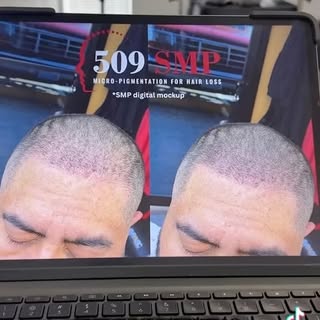 What is up Tri-Cities Washington? If you guys have any questions about scalp micro pigmentation (SMP