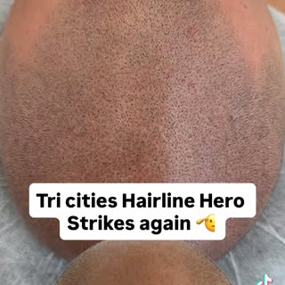¡Es hora de darle fuerza a esa línea frontal! 😤
Let’s strengthen that hairline that’s lackin’! 😤
C