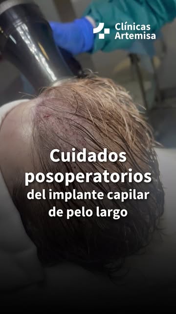 La magia del injerto de pelo largo es que el cambio es inmediato.😍 Pero los cuidados en el postoper