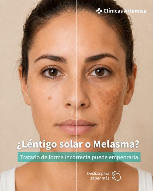 Usar el mismo tratamiento para un léntigo que para un melasma es un error muy común tras las vacacio