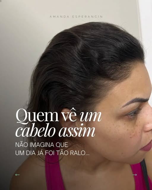 Esse antes e depois não aconteceu por acaso.
Cada mudança nesse cabelo veio de uma decisão tomada a 