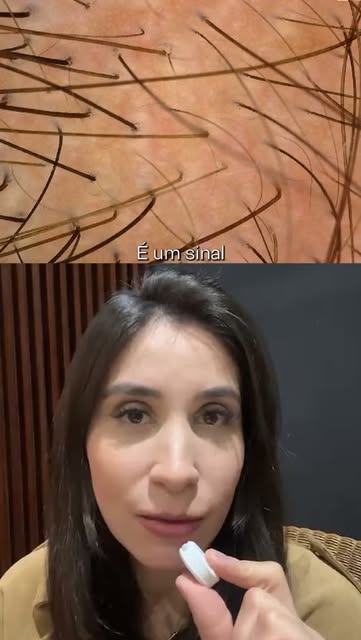 Os sinais que eu mostrei no vídeo são pistas de algumas condições, mas não é possível fechar um diag