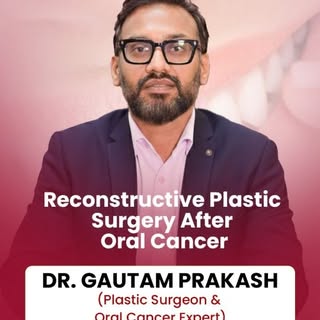 🎗️ Free Flap Surgery: Oral Cancer ke baad nayi zindagi ki umeed

Oral cancer ke treatment ke baad c