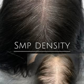 SMP Density 👌

SMP density is about creating the right number and distribution of pigment impressio