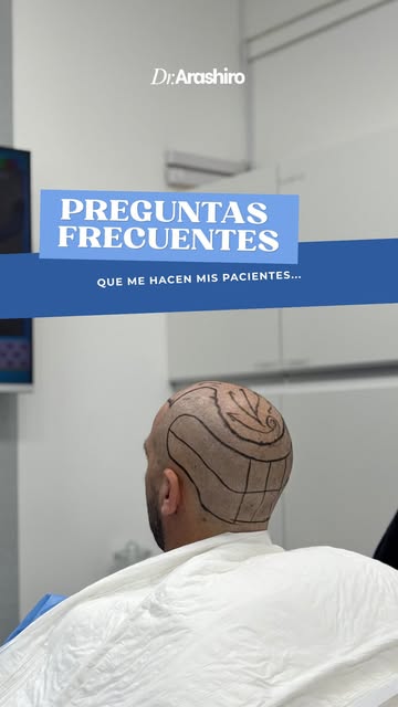 ¿Se me cayeron 50 pelos hoy… ¿es normal? 👀

Esta es una de las preguntas que más recibo en consulta