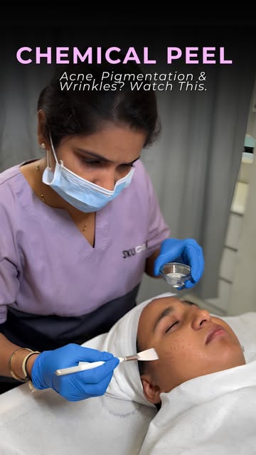 Demystifying your skin wellness journey with expert-led clarity: Uncovering the Power of Chemical Pe