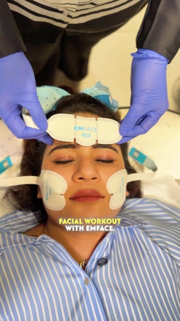 Post Partum it is important to Workout Your Face in Real Time and it is now possible with FDA approv