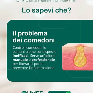 🧬 Il comedone non è semplicemente “sporco” sulla pelle: nasce quando sebo e cellule cutanee si accu