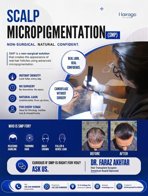 Scalp Micropigmentation (SMP) is a premium, non-surgical solution designed to replicate the appearan