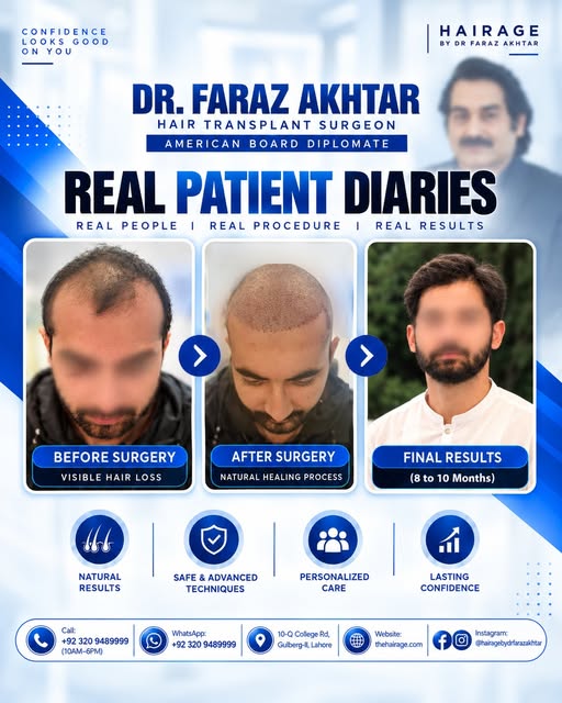 Real Patient Diaries | Real People. Real Procedures. Real Results.

Every hair restoration journey i