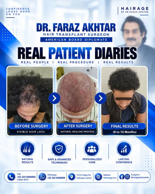 Real Patient Diary | A Journey from Hair Loss to Natural-Looking Results

Every hair transplant jour