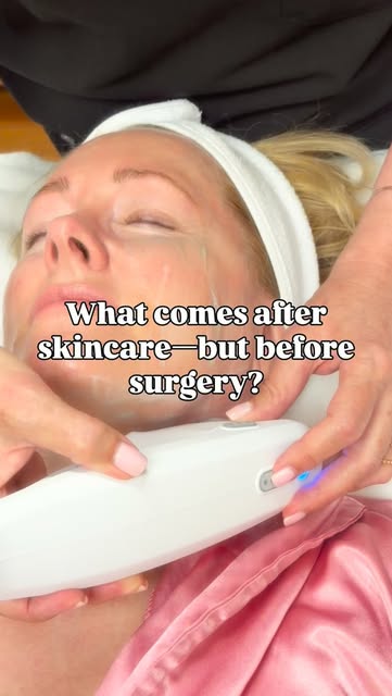 There is a lot more happening beneath this handpiece than you can see.

Ultherapy PRIME uses microfo