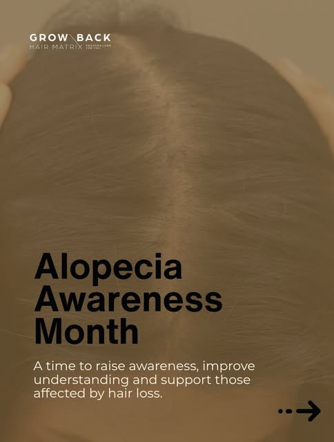 September is Alopecia Awareness Month.

Alopecia can look different from person to person.

For some