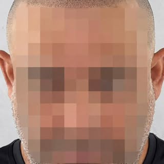 A dor da calvície acaba quando você volta a se sentir você.
Mais que estética. Autoestima devolvida 