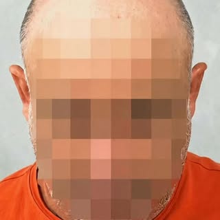A dor da calvície acaba quando você volta a se sentir você.
Mais que estética. Autoestima devolvida 