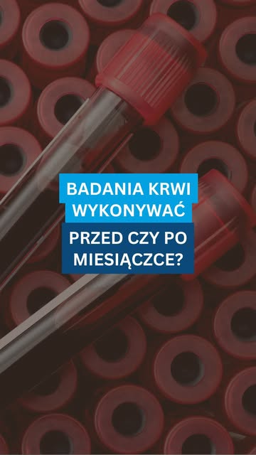 Jeśli regularnie wykonujesz badania laboratoryjne, warto zwrócić uwagę nie tylko na to, co sprawdzam