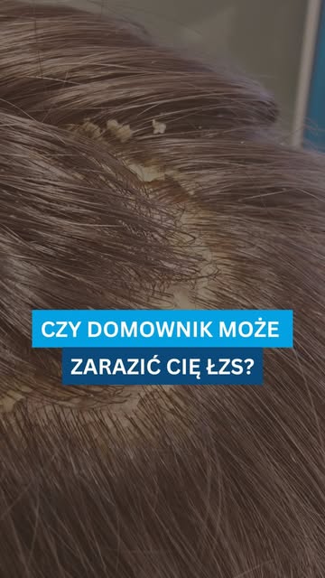 To jedno z najczęstszych pytań, które pojawia się u osób zmagających się z ŁZS.

👉 Odpowiedź brzmi: