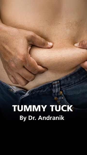 Male Tummy Tuck: Sculpt a Defined, Athletic Core
Diet and exercise can only do so much.
Male abdomin