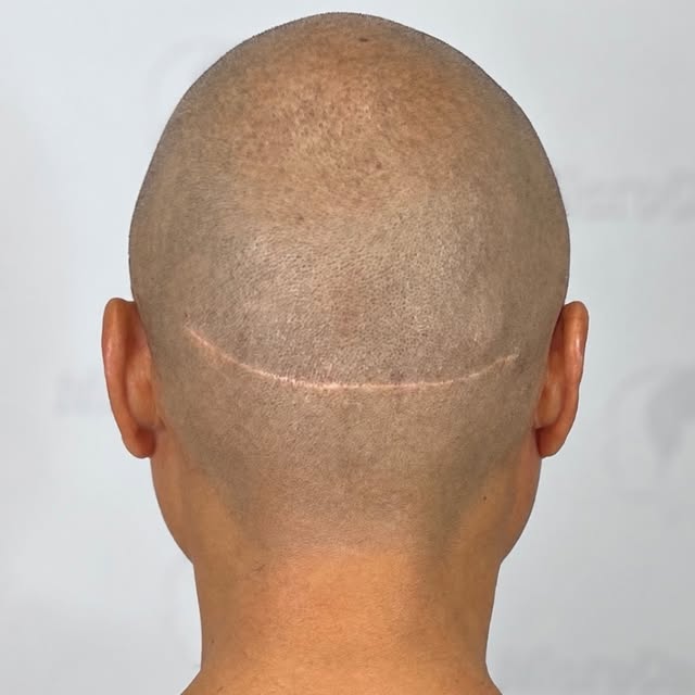 They call me the Scar Killer. This is why. 🪦🔥 FUT scar camouflage done with precision. Zoom in I s