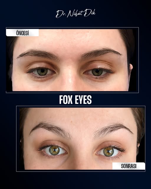 Fox Eyes uygulamasında, göz çevresinin ve bakışların görünümünü etkileyen detaylar kişiye özel olara