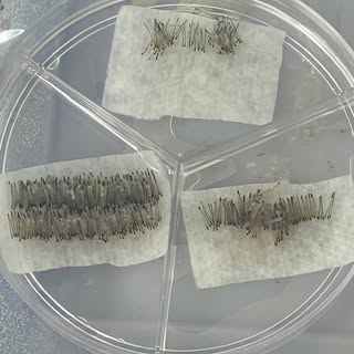 🔷 Grafts 🔹1 hair , 2 hairs and 3 hairs 🔷