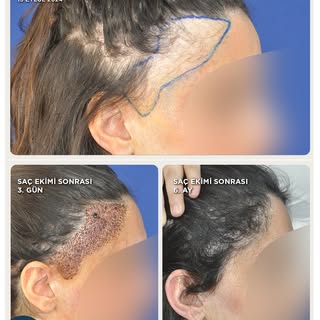 Burns, traffic accident injuries, infections, radiation, tumor surgery, and surgical scars can all c