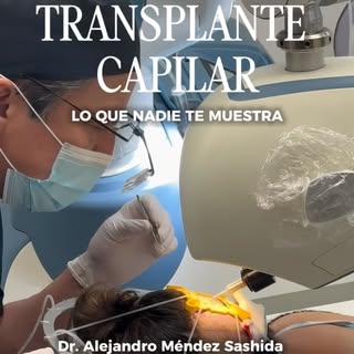 ¿Cómo funciona el robot ARTAS en un trasplante de cabello? 🤖 Hoy respondemos una de las preguntas m