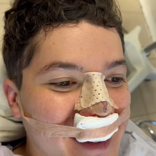 Así luce un paciente minutos después de una rinoplastia.

Realizar tu cirugía con un cirujano plásti