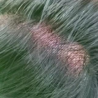 Authentic Hair Patch ❤️‍🩹

Dear Customers 
Quality Matters ....Its all about your beauty an persona
