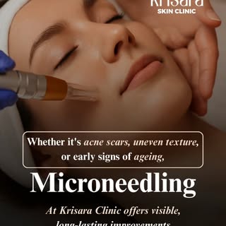 ✨ Struggling with acne scars, uneven skin texture, open pores, or early signs of ageing?
Your skin d