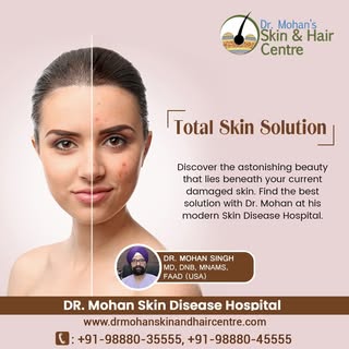 Total skin solution
Dr. Mohan Skin Disease Hospital
Website: https://drmohanskinandhaircentre.com/
P