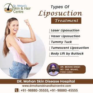 Types of Liposuction
Dr. Mohan Skin Disease Hospital
Website: https://drmohanskinandhaircentre.com/
