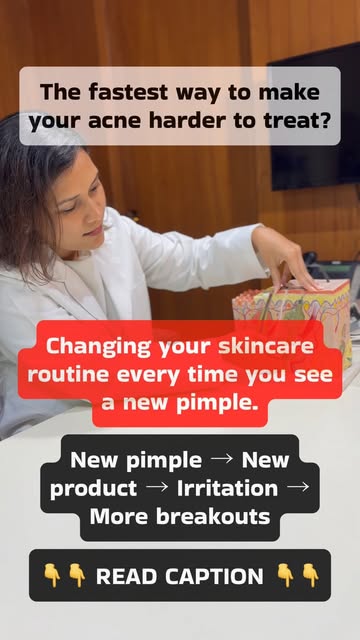 A new pimple does not automatically mean your acne treatment has failed.

This is one of the most co