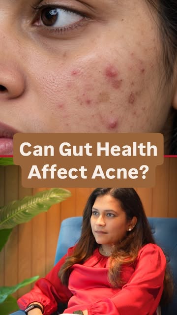 Could your skin be telling you something about your gut? 🧬

🔹 The gut and skin communicate through