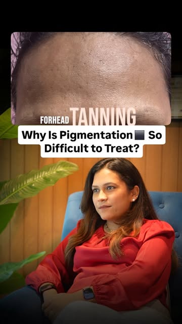 Why does pigmentation keep coming back even after you treat it? 👀

• Dark patches can have very dif