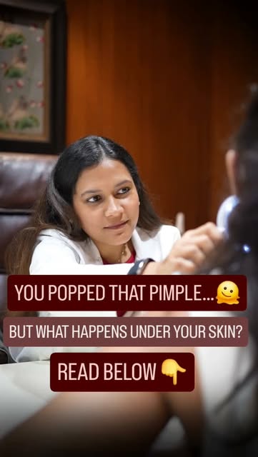 That satisfying pop might come with a price 👀

• Squeezing a pimple can push its contents deeper in