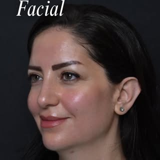 The facial your skin has been asking for. ✨

A complete refresh for smoother texture, deeper hydrati