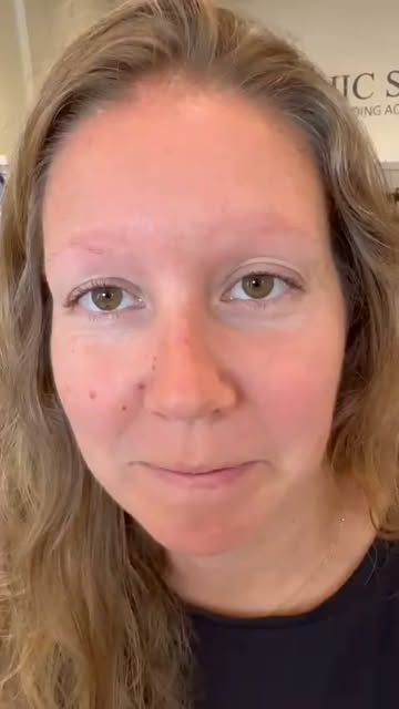 Huge Labor Day Sale 
20% Extra Discounts!
From no Eyebrows to full lush eyebrows. She looks absolute